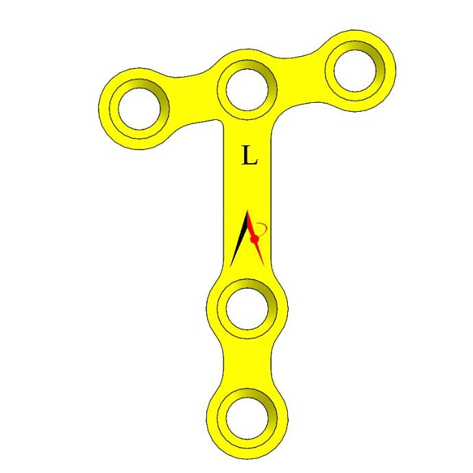MINI PLATE T ANGLE RIGTH & LEFT
